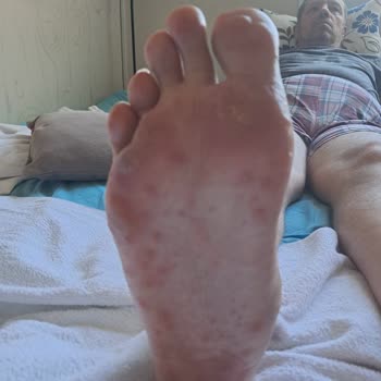 Egepol Hastanesi Yanlış Tedavi Ve İlgisiz Doktor Deneyimi