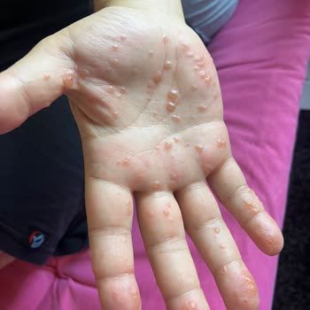 Egepol Hastanesi Yanlış Tedavi Ve İlgisiz Doktor Deneyimi