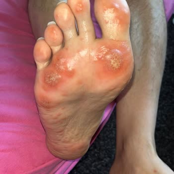 Egepol Hastanesi Yanlış Tedavi Ve İlgisiz Doktor Deneyimi