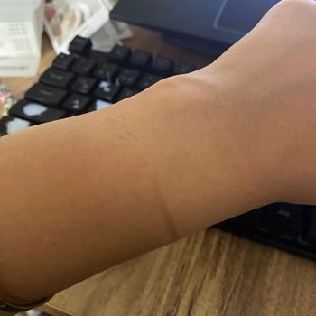 Pandora Bileklik Sorunu: Dar Gelen Bileklik Ve Çözüm Eksikliği