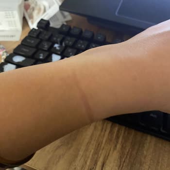 Pandora Bileklik Sorunu: Dar Gelen Bileklik Ve Çözüm Eksikliği