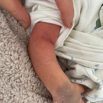 Bebek Kan Alımında Yetersiz Hemşirelik Hizmeti