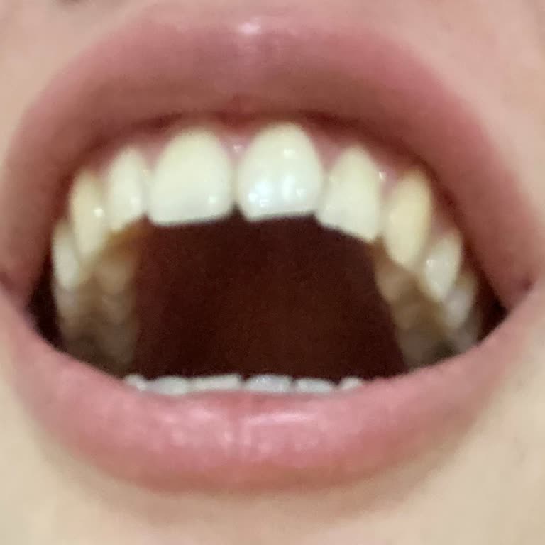 Para Odaklı Ve İlgisiz Tedavi: Dişlerim Daha Da Bozuldu