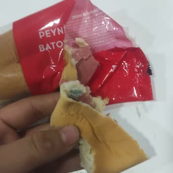 Son Kullanma Tarihi Geçmiş Ürün Yüzünden Hastane Yolculuğu