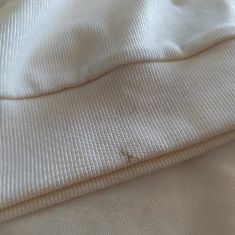 Trendyol Machetta İadeyi Onaylamadı!