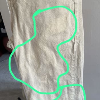 Vanish Kosla Zara Pantolonumda Leke Çıkarma Kabusu