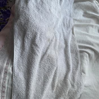 Bosch Çamaşır Makinesi Leke Sorunu Ve Müşteri Memnuniyetsizliği