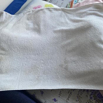 Bosch Çamaşır Makinesi Leke Sorunu Ve Müşteri Memnuniyetsizliği