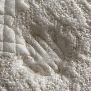 Hasarlı Yatak Ve Yetersiz Çözüm Süreci