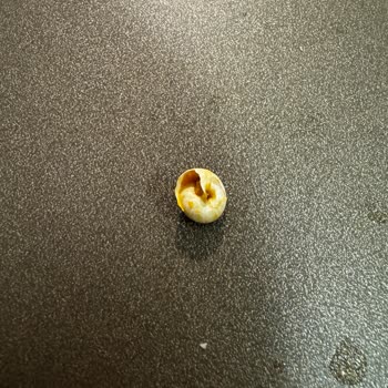 Migros Garnitürden Çıkan İstenmeyen Sürpriz