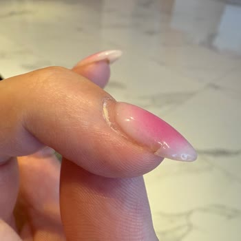 Protez Tırnak Hizmetinde Memnuniyetsizlik