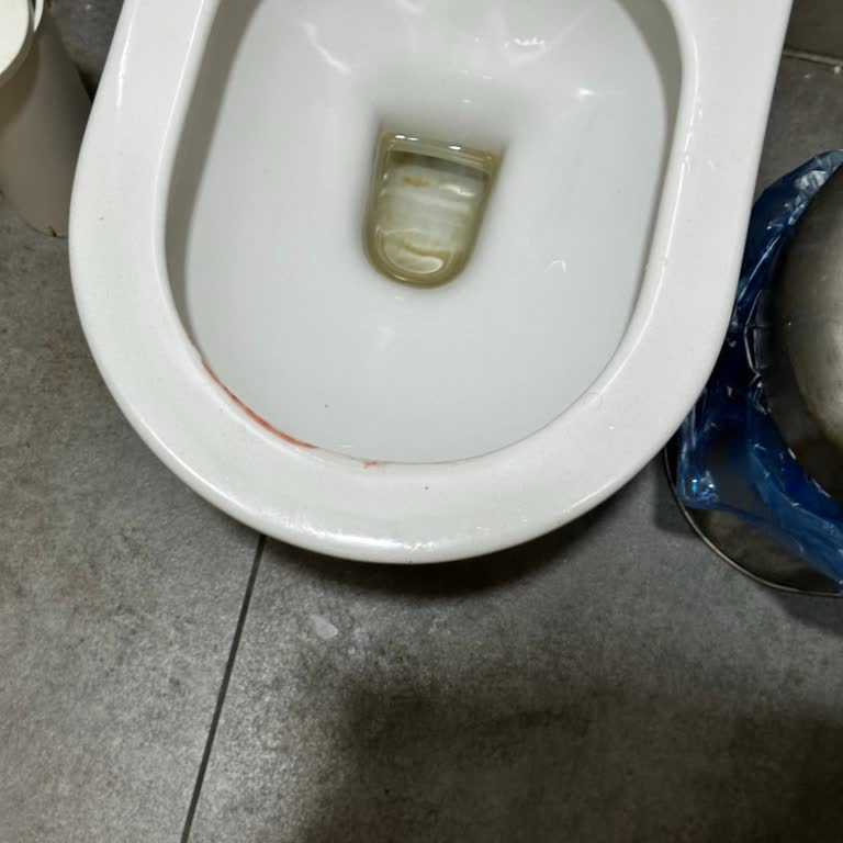 Hijyen Sorunları Ve Sağlık Riski