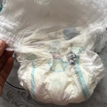 Molfix Bebek Bezi Sızıntı Sorunu