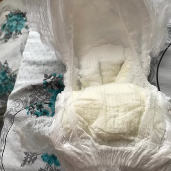 Molfix Bebek Bezi Sızıntı Sorunu