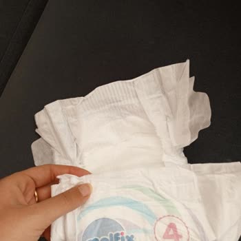 Molfix Bezi Pişik Sorunu