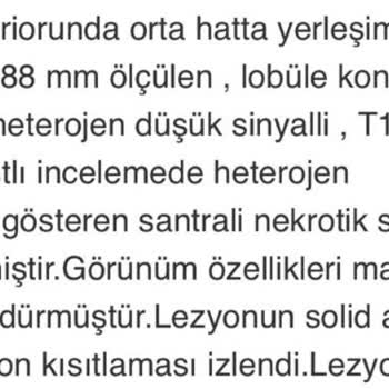 Türkiye Sigorta'nın Ameliyat Masraflarını Karşılamaması