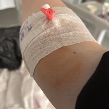 Yanlış Tedavi Sonrası Hastanede Zorunlu Yatış