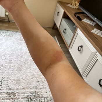 Yanlış Tedavi Sonrası Hastanede Zorunlu Yatış