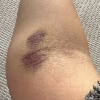 Acil Serviste Hemşire Hataları Ve İletişim Sorunları