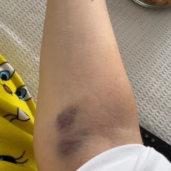 Acil Serviste Hemşire Hataları Ve İletişim Sorunları