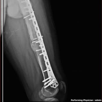 Sağlık Bakanlığı Engelli Raporu Mağduriyeti