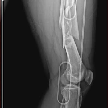 Sağlık Bakanlığı Engelli Raporu Mağduriyeti