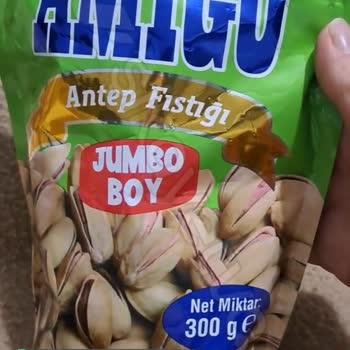 Amigo Hijyenik Değil