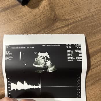 Özel Hastanede Hijyen Skandalı: Hamilelikte Karşılaştığım Sorunlar