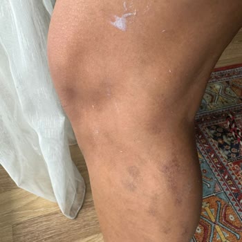 Lady Shine Güzellik Merkezi Mağdur Edilmem