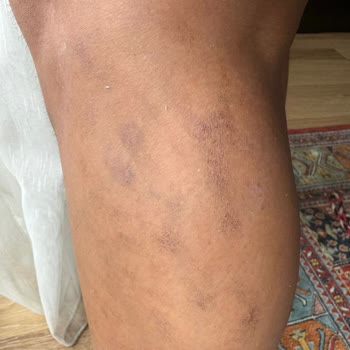 Lady Shine Güzellik Merkezi Mağdur Edilmem