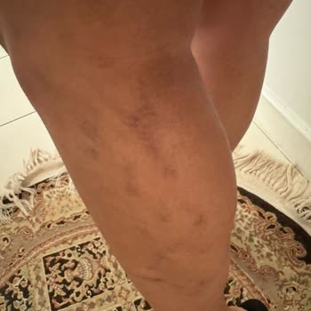 Lady Shine Güzellik Merkezi Mağdur Edilmem