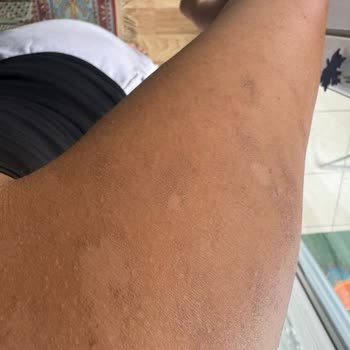 Lady Shine Güzellik Merkezi Mağdur Edilmem