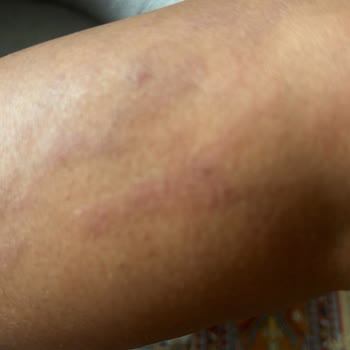 Lady Shine Güzellik Merkezi Mağdur Edilmem