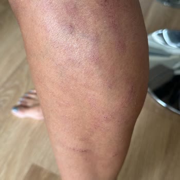 Lady Shine Güzellik Merkezi Mağdur Edilmem