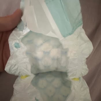 Kalitesiz Bebek Bezi Mağduriyeti