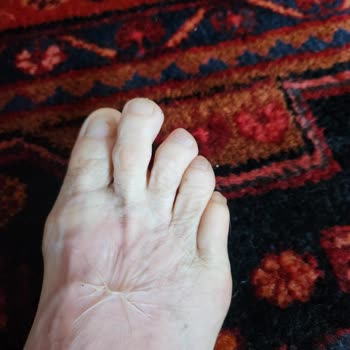 Arçelik Güvenlik Sorunu: Kahve Makinesi Kazası