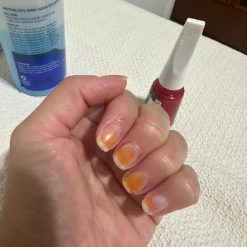 Flormar Ojesi Tırnakta Kalıcı Lekeler Bırakıyor!