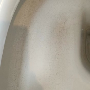 Vitra Klozetlerde Kalıcı Lekeler Ve Yetersiz Müşteri Hizmeti