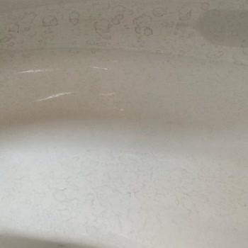 Vitra Klozetlerde Kalıcı Lekeler Ve Yetersiz Müşteri Hizmeti