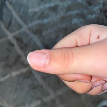 Tırnak Hizmetinde Yaşanan Sorunlar