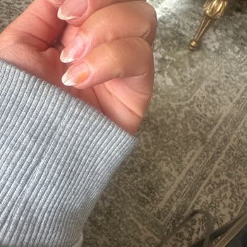 Flormar Oje Sonrası Tırnaklarda Sararma Sorunu