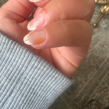 Flormar Oje Sonrası Tırnaklarda Sararma Sorunu