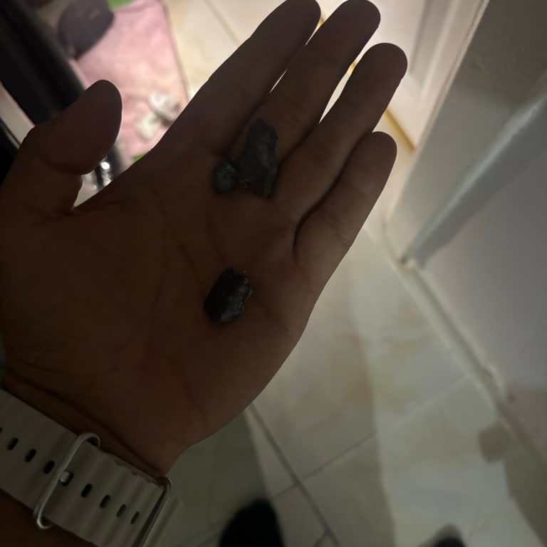 Arçelik Çamaşır Makinesi Sorunu Ve Yetersiz Servis