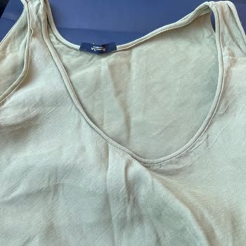 İade Sürecinde Mağduriyet