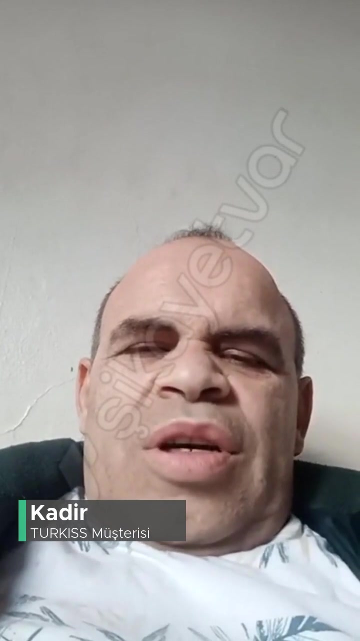 Turkıss Mobil Kırmızı Yanıyor İnternetim Yok! videonun kapak resmi