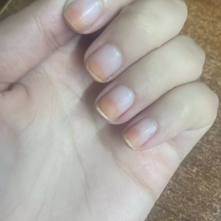 Flormar Ojesi Tırnakta Kalıcı Leke Sorunu