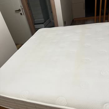 Pahalı Yatakta Beklenmedik Sararmalar Ve İlgisiz Hizmet