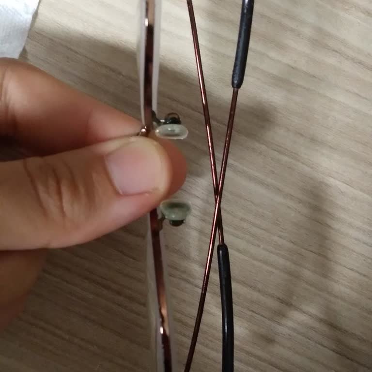 Gözlük Tamiri Sonrası Artan Rahatsızlık Ve Çerçeve Sorunu