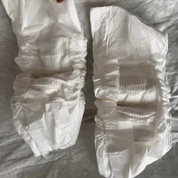 Molfix Pure And Soft Bezlerde Lastik Bariyer Sorunu