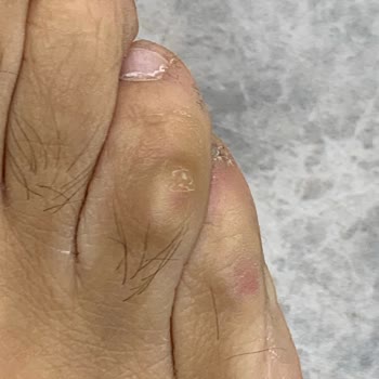SuperStep Mağazasından Alınan Ayakkabı Ayağıma Zarar Verdi
